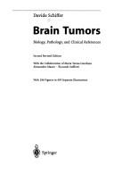 Brain tumors