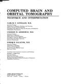 Computed brain and orbital tomography