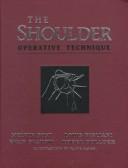 The shoulder