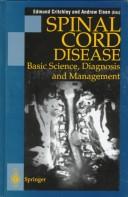 Spinal Cord Disease